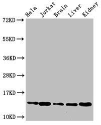 HIST1H2BB (Ab-16) antibody
