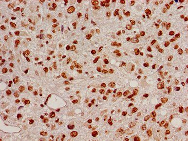HIST1H2BB Antibody