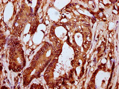 HIST1H2BC Antibody