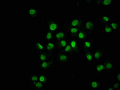 HIST1H2BC Antibody