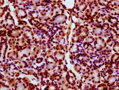 HIST1H2BC Antibody