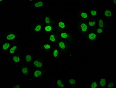 HIST1H2BC Antibody