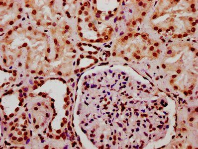 HIST1H2BC Antibody