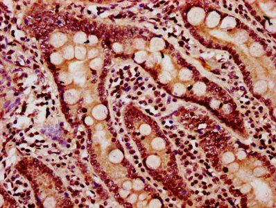 HIST1H2BC Antibody
