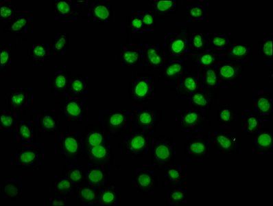 HIST1H2BC Antibody