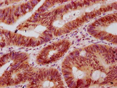 HIST1H2BC Antibody