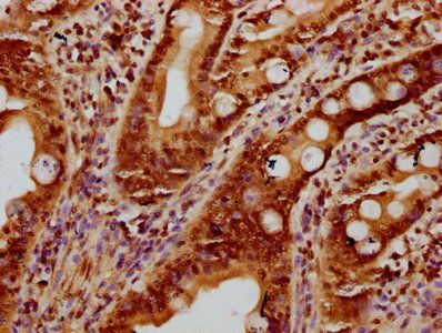 HIST1H2BC Antibody