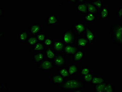 HIST1H2BC Antibody