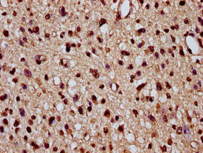 HIST1H2BC Antibody