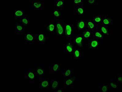 HIST1H2BC Antibody