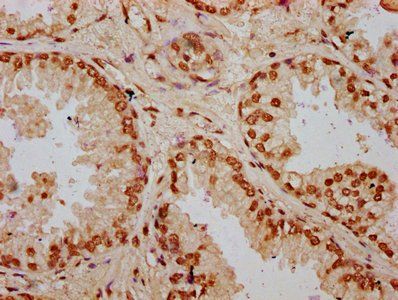 HIST1H2BC Antibody