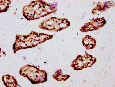 HIST1H2BC Antibody