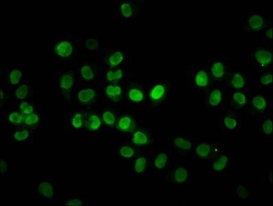 HIST1H2BC Antibody