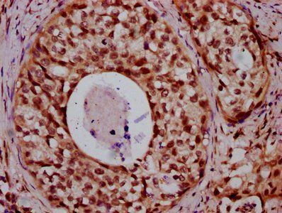 HIST1H2BC Antibody