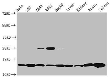 HIST1H2BC Antibody
