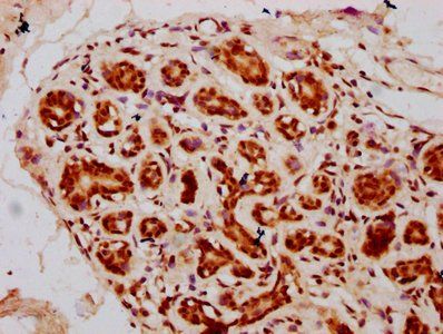 HIST1H2BC Antibody