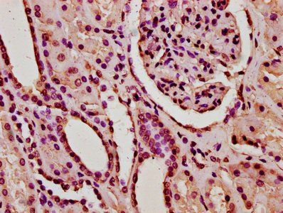 HIST1H2BC Antibody