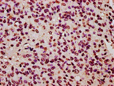 HIST1H2BC Antibody
