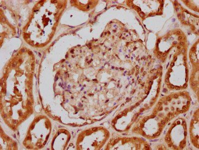 HIST1H2BC Antibody