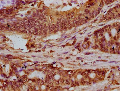 HIST1H2BC Antibody