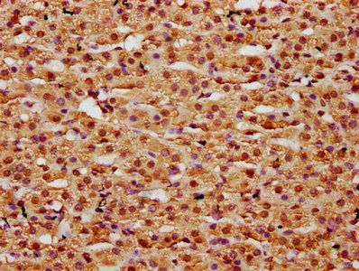 HIST1H2BC Antibody