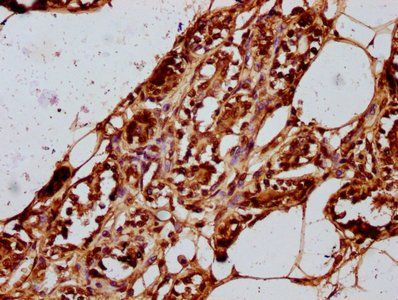 HIST1H2BC Antibody
