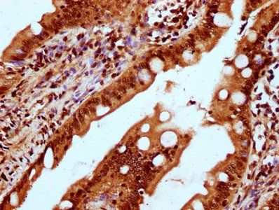 HIST1H2BC Antibody