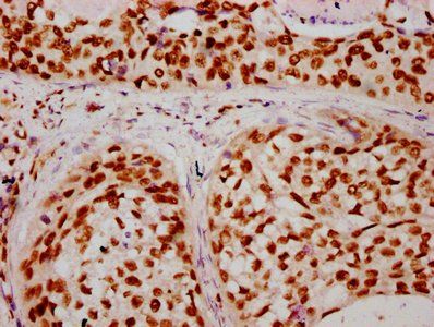HIST1H2BC (Ab-16) Antibody