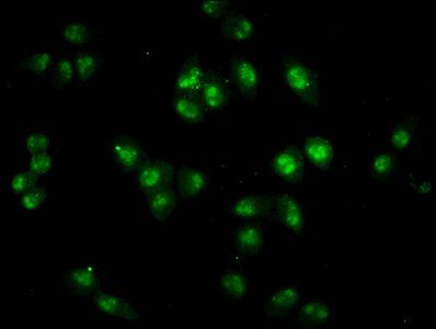 HIST1H2BC (Ab-20) antibody