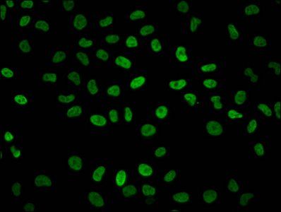 HIST1H2BC (Ab-23) Antibody