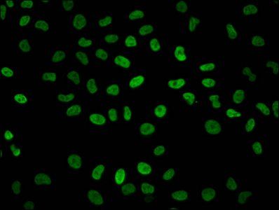 HIST1H2BC (Ab-23) antibody