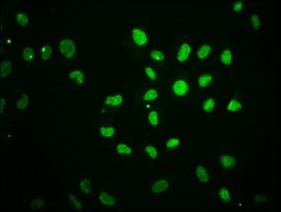 HIST1H2BC Antibody