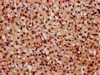 HIST1H2BC Antibody