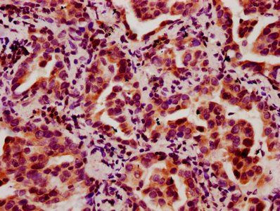 HIST1H2BC Antibody