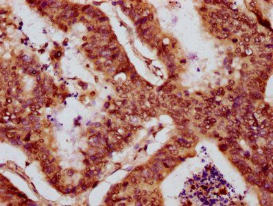 HIST1H2BC Antibody