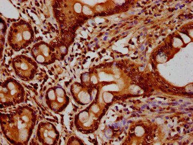 HIST1H2BC Antibody
