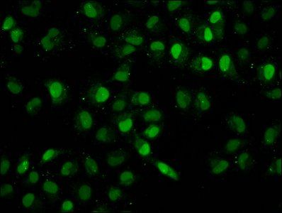 HIST1H2BC Antibody