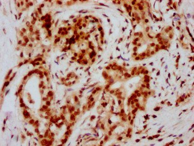 HIST1H2BC Antibody