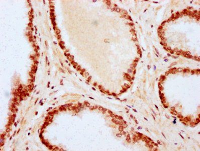 HIST1H2BC Antibody