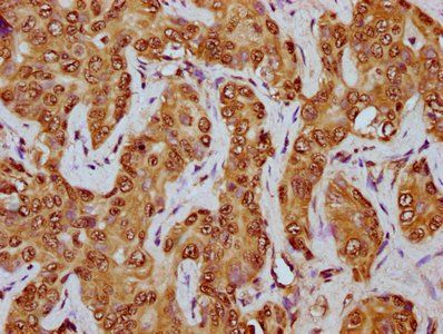 HIST1H2BC Antibody