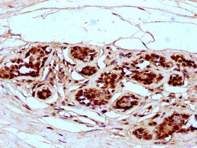 HIST1H2BC Antibody