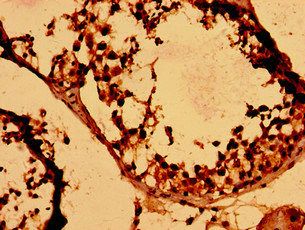 HIST1H2BK Antibody