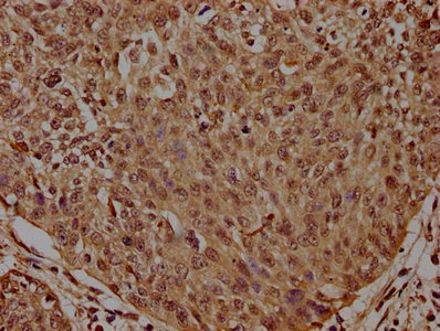 HIST1H2BL antibody