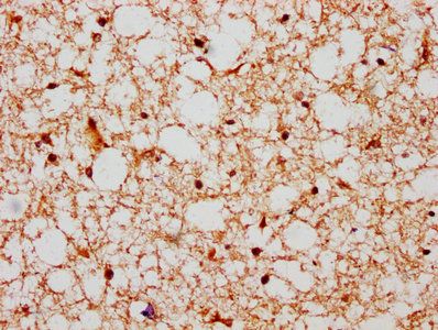 HIST1H2BN Antibody