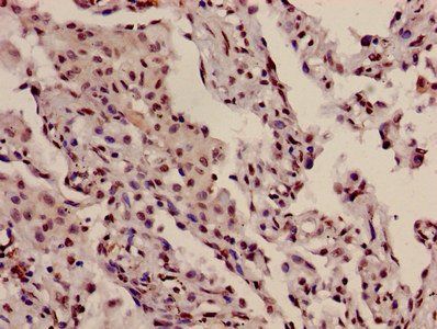 HIST1H3A (Ab-10) Antibody