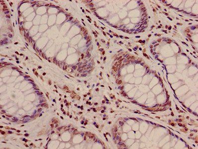 HIST1H3A (Ab-10) Antibody