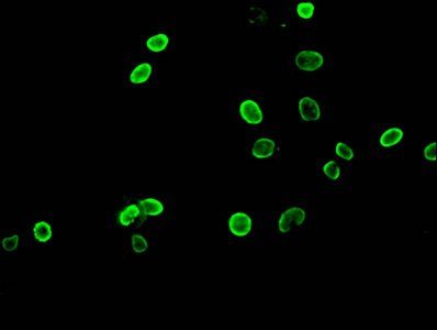 HIST1H3A (Ab-10) antibody