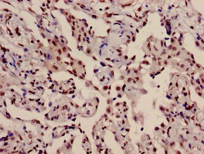 HIST1H3A (Ab-10) Antibody