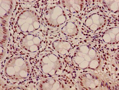 HIST1H3A (Ab-10) Antibody