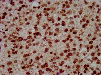 HIST1H3A (Ab-10) Antibody